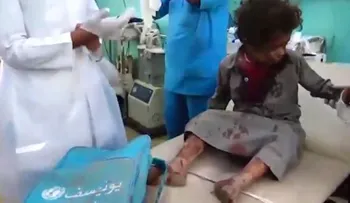 Decenas de niños que iban en un autobús escolar mueren por un bombardeo en Yemen