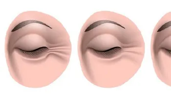 Crema de 3 ingredientes para reducir las arrugas de los ojos