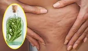 Alcohol de romero para acabar con la celulitis, varices, la gota y dolores musculares!!