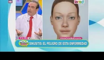 Sinusitis: El peligro de esta enfermedad