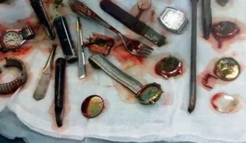 Acorralado por la Policía, un delincuente se â??comióâ? seis relojes, un tenedor, una cuchara, un corta uñas y otros bienes que había robado
