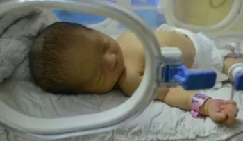 El "bebé más pequeño del mundo", a punto para salir del hospital