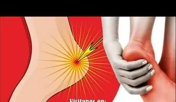 Si te duele el talón al despertar o sin estar parado mucho tiempo, esto le está pasando a tu cuerpo