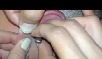 Un hombre con una mariposa y una garrapata en el oído