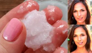 Así eliminé mis arrugas y limpié naturalmente mi cara en pocos dÍas con esto que tengo en mi mano