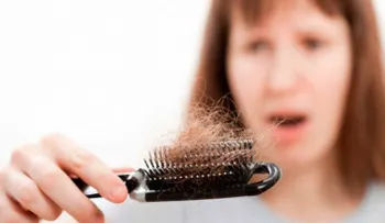 La pérdida lenta del cabello obedece a posibles factores hereditarios
