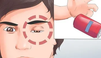 Conoce los síntomas de un derrame cerebral antes de que suceda