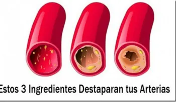 3 ingredientes que destapan las arterias y protegen al corazón