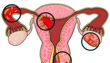 Vagina hinchada causas y tratamientos naturales