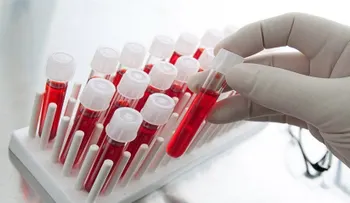 Potencial prueba de sangre para detectar cualquier tipo de cáncer