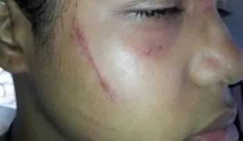 Madre denuncia que pandilla le propinó una paliza a su hija en liceo de SPM