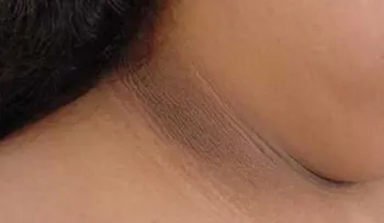 4 formas de quitar el cuello oscuro