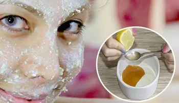 Ella logró blanquear su piel y eliminar las manchas oscuras de su cara, con solo 3 ingredientes! 