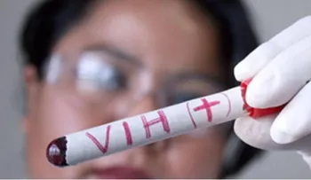  Una mayor cantidad de casos VIH en menores de 30 años, por poco uso de preservativos