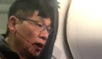 El polémico pasado del doctor David Dao desalojado del vuelo de United Airlines