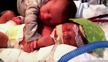 Desgarradora foto de gemelos recién nacidos abrazados se vuelve viral