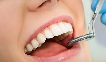 Personas con diabetes corren riesgo de tener infecciones en la boca