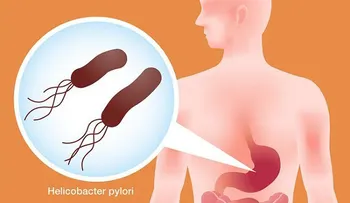 Elimina la bacteria Helicobacter Pylori con los consejos de este médico japonés