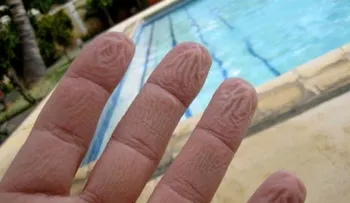 ¡Así que ESA es la razón del por qué se arrugan los dedos en el agua!
