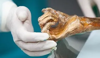 La línea genética materna de la momia Ã?tzi está extinguida, según un estudio