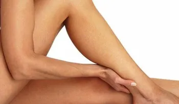 Consejos para prevenir las várices