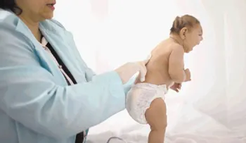Informe sobre el nacimiento de niño con anomalías congénitas, incluso microcefalia.