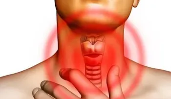 Esta es la única receta que cura infección de garganta en 4 horas; remedio para la tos, gripe y limpiar tus pulmones