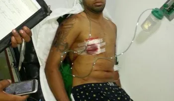 Buscan preso que se escapó herido de una clínica