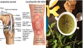 Te duelen las rodillas y articulaciones? eliminalo en un día sin necesidad de inyecciones