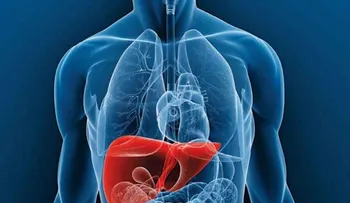  Hígado graso; una enfermedad "silenciosa" que puede derivar en cirrosis o cáncer 