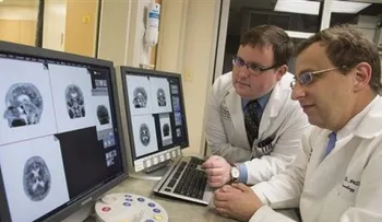 Tomografía muestra proteína que indica alzhéimer