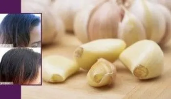 Jugo de ajo contra la caída del cabello