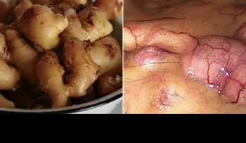 El jenjibre, mira lo que le hace al cuerpo si lo comes todos los días