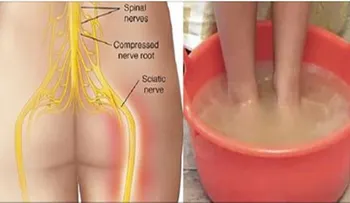 El dolor del nervio ciático y cómo decirle adios con este médoto natural