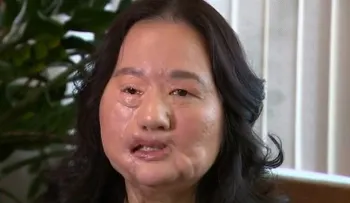 No hace mucho tiempo, esta mujer era una belleza. ¡Su historia conmociona!