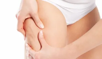 ¡Entérate!: Cómo eliminar la celulitis fácilmente