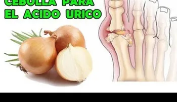 Ácido úrico eliminalo con solo 2 cebollas 