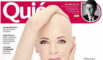 Edith González, pese a su terrible enfermedad posa sin peluca para la portada de una revista