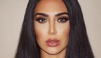 Kardashian: â??Le dijimos que tenía lesión cerebralâ?