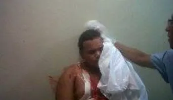 Joven denuncia golpiza le dio un policía en Montecristi