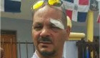 Alcalde dominicano herido macanazo