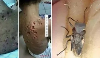 ADVIERTEN: La picadura de este mosquito puede ser mortal (VIDEO)