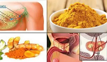 Mejor que la quimioterapia: este ingrediente mata al cáncer no a los pacientes