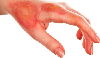 Esto es lo que PASA  incluye APIO en tus comidas: Sirve para el colesterol, diabetes, la gota y otras enfermedades 