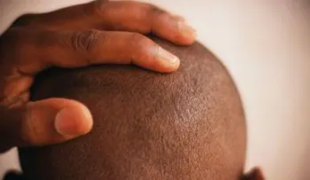 Datos curiosos sobre el cabello (y los problemas capilares)