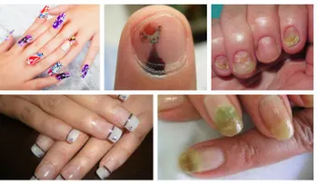 Usaba uñas acrílicas y lo que le pasó te dejara sin alientos 
