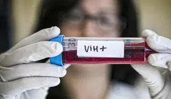 Científicas  hacen importante estudio para aumentar tiempo de vida portadores VIH