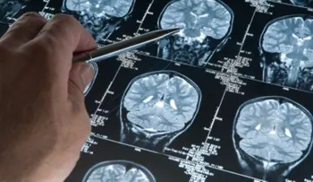 Jazz y rap, dos estilos que necesitan un cerebro improvisador