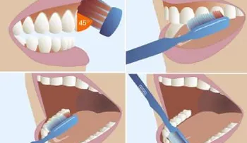 ¿Cuál es la mejor manera de cepillarse los dientes?