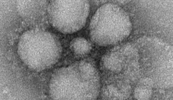 Peligro de epidemia mundial: Aparece virus mortal puede pasar de los murciélagos a los humanos
